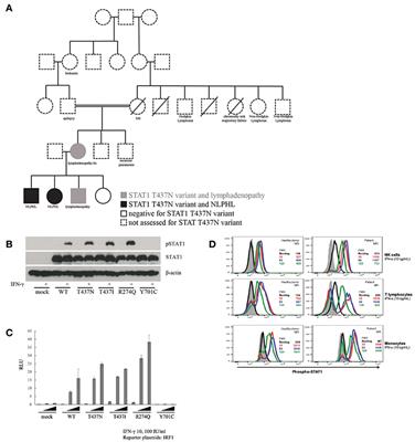 Gain-of-Function STAT1 Mutation With Familial Lymphadenopathy and Hodgkin Lymphoma